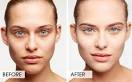 Bags Under Your Eyes? Pictures of 11 Healthy Ways to Get Rid of