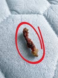 Uyandığımda sırtımın &uuml;st kısmında bir şeyin acıdığını ...