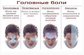 Головная боль