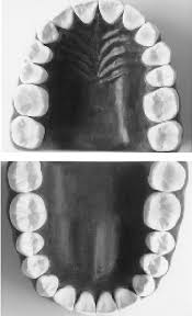 Image result for macro mandibular