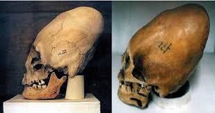 Elongated Human Skulls Of Peru: Secret Video And Photos Images?q=tbn:ANd9GcQBIO_fiD2o9weyvQ9mKd7EMWDcYNkOpGwiyFTOEWBd6cJaVyjr