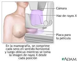 Resultado de imagen para mamografías, imagenes