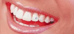 Image result for Root canal dentist in kanpur