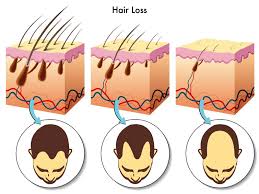 Image result for frequently asked questions by patients undergoing hair transplant surgery