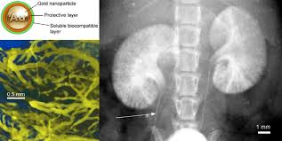 Image result for x ray of kidney