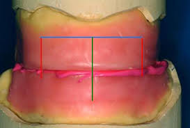 Resultado de imagen para rodetes de cera dental