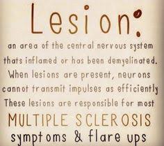 Living with Neuromyelitis Optica/ Multiple Sclerosis on Pinterest ... via Relatably.com