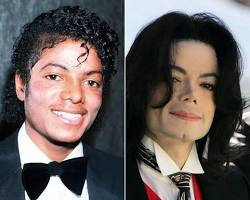 Imagen de Michael Jackson before and after plastic surgery