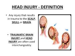 Image result for injury head