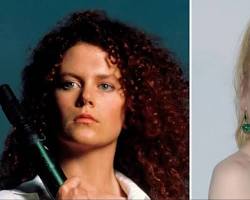 Imagen de Nicole Kidman before and after plastic surgery