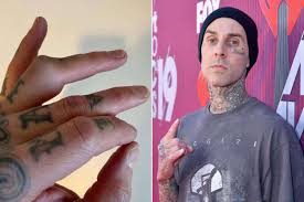 Travis Barker: Preparing for Surgery and Sharing Graphic Photos of His Injured Ring Finger