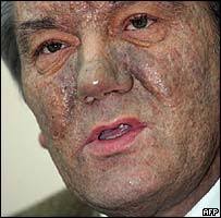 Viktor Yushchenko. Yushchenko&#39;s disfigurement could take two years to heal - _40640931_yushafp203big