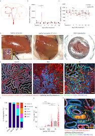 Unraveling the Progression of Acute Kidney Injury: A Longitudinal Study Tracing Injury Spread within the Nephron - 1