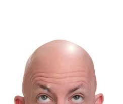 Image result for bald head