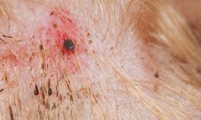 Image result for Vector Borne Diseases