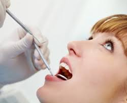 Imagini pentru extractie dentara