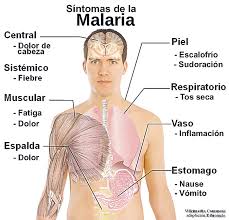 Resultado de imagen para malaria