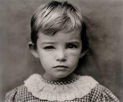 SALLY MANN (B. 1951) | Damaged Child, 1984 | Photographs Auction | 1980s, Photographs | Christie&#39;s - d5236039l