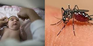 Image result for bahaya virus zika
