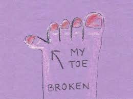 Image result for broken toes