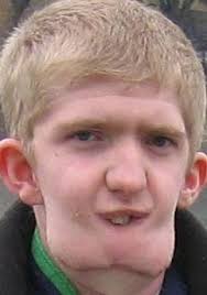 Doctors in New York said they are extremely pleased with how the final operation to give Ulster teenager Alan Doherty his dream of a new chin has gone. - alan-doherty