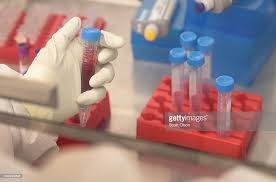 Image result for aids vaccine research
