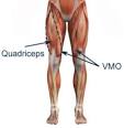 Quadriceps