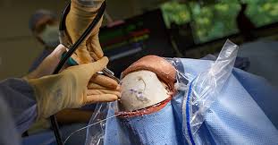 Simulator provides real experience for brain surgeons in training ...