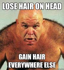 Losing Hair Meme – Hair Loss Treatment via Relatably.com