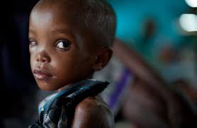 MSF is currently treating over 7,000 children for malnutrition in this, one of three camps at Dadaab. (Phil Moore/AFP/Getty Images) # - f06_19625569