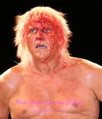 Tommy Rich is a bloody mess after his bout with Abdullah the Butcher. - rich_abby3_story
