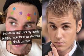 Justin Bieber Shares Post-Facial Selfie Covered in Pimple Patches: 'I Think 
My Face Is Purging'
