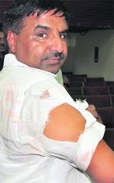 Kurukshetra District Congress president Jai Bhagwan Sharma shows his injuries. Tribune photos - har2
