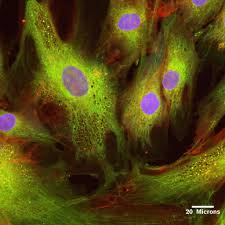 Image result for mesenchymal stem cells knee