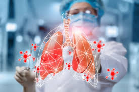 Occupational respiratory Australia Launches Historic National Occupational Respiratory Disease Registry