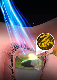 healing power of light Advancing Eye Repair: Unlocking the Healing Power of Light