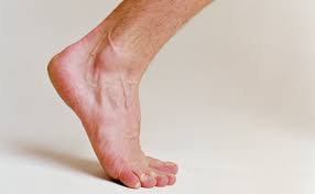 Image result for image of foot pain healed