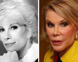 Imagen de Joan Rivers before and after plastic surgery