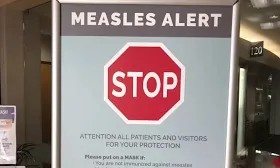 AHS confirms case of measles in Edmonton