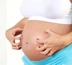 gatal seluruh badan ketika hamil, set kehamilan shaklee
