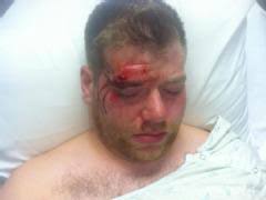 Danny Hawkins, a gay rights advocate and board member of OutSpokane, said he was assaulted after leaving a popular gay bar in downtown Spokane. - hawkins