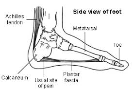 Image result for achilles tendonitis and plantar fasciitis
