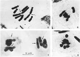 Heterochromatin Patterns in Some Taxa of Crepis Praemorsa ...