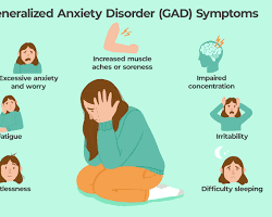 Image of Anxiety disorders