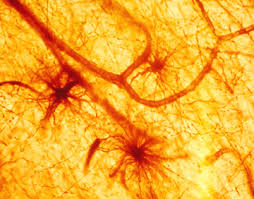 Image result for Astrocytes