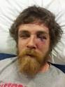 Son of Wis. State Senator Reportedly Assaulted While Protecting ... - Hospital+Photo