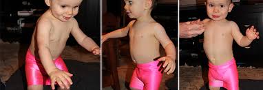 Image result for pediatric excessive hip mobility + image