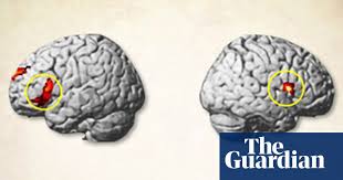 Brain-controlling magnets: how do they work? | Science | The ...