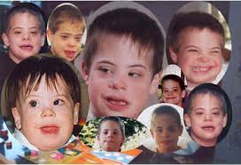 Down Syndrome images?q=tbn:ANd9GcT