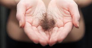 Hasil gambar untuk hair loss